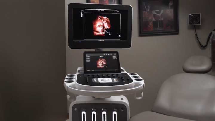 Dr. Michael Ruma stellt die Philips Ultraschallanwendungen TrueVue Pro, TouchVue, MPR Touch, Touch Sculpt, Touch Erase, Touch Zoom und aReveal vor