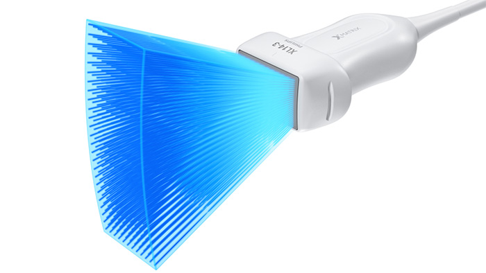 Einfache 3D/4D-Funktionalit&auml;t