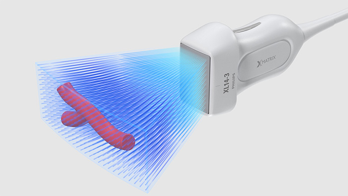 3D/4D-Aufl&ouml;sung in hoher Qualit&auml;t