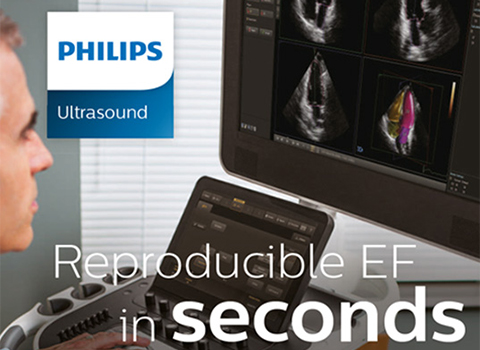 Reproducible EF in seconds – Philips EPIQ 7 HeartModelᴬ⋅ᴵ⋅ (Reproduzierbare EF innerhalb von Sekunden – Philips EPIQ 7 HeartModelᴬ⋅ᴵ⋅)